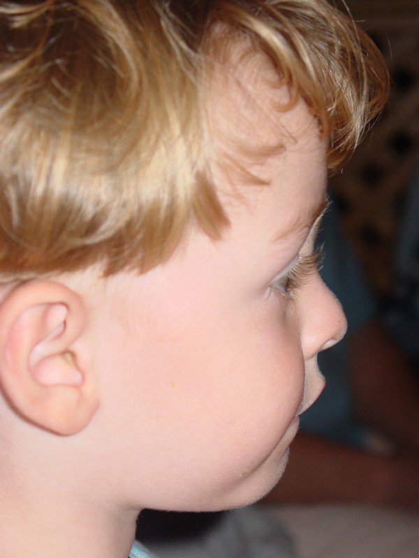 Click for original image 747k 1200x1600